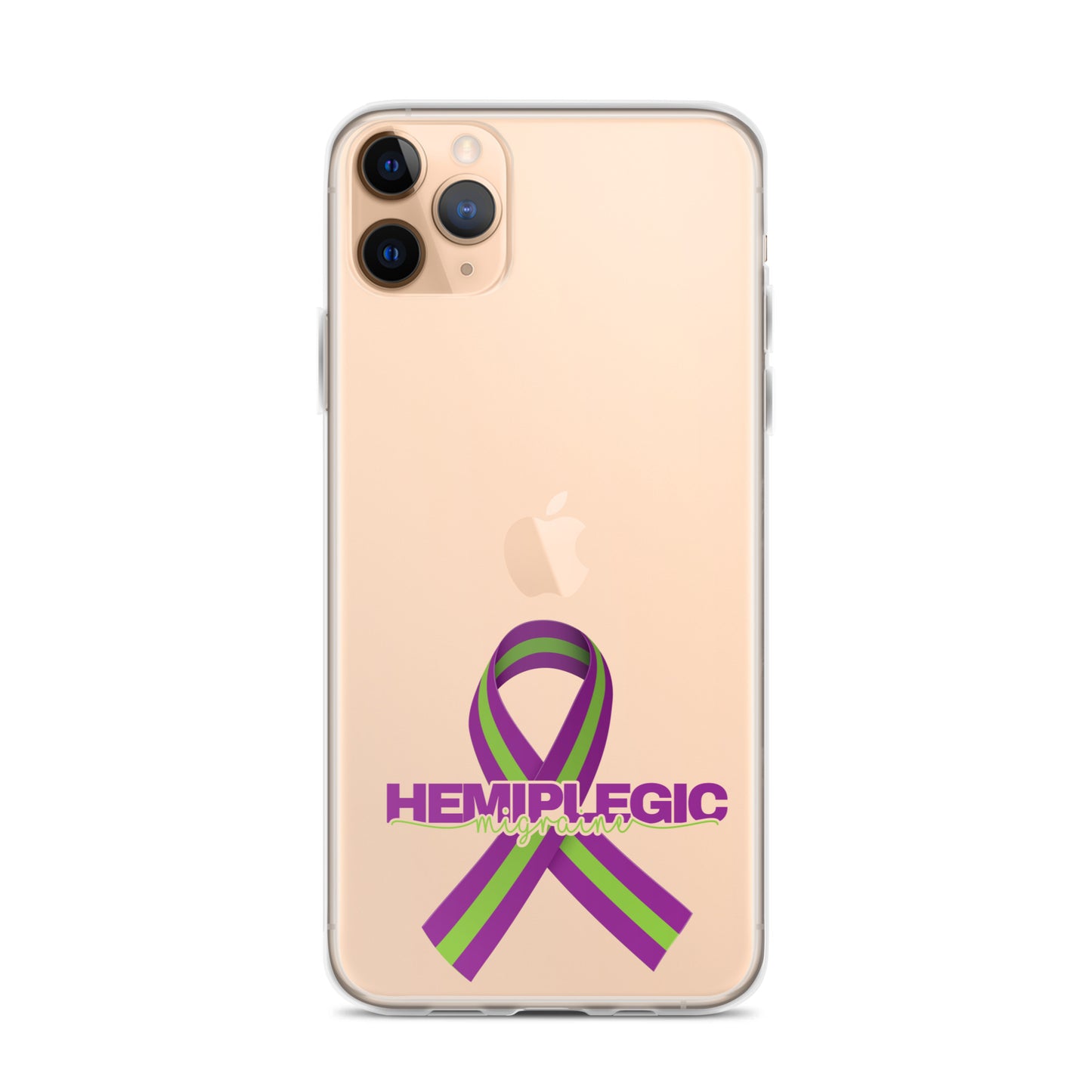 HM iPhone Case